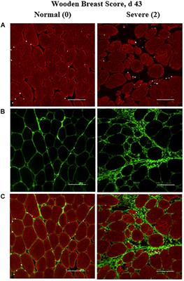 Characterization of Pectoralis Major Muscle Satellite Cell Population Heterogeneity, Macrophage Density, and Collagen Infiltration in Broiler Chickens Affected by Wooden Breast